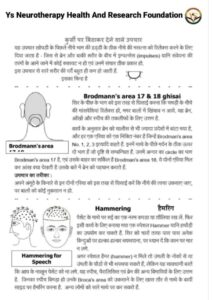 Brodman aria 17 and 18 ghisai and Hammering